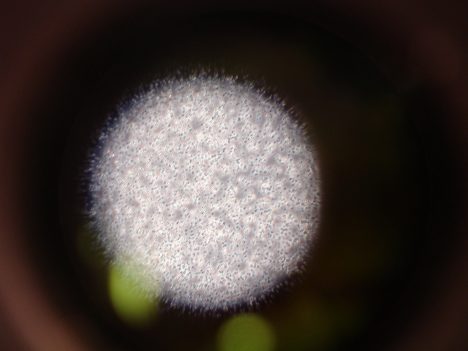 Micrococcus luteus Bakterien sind ein Teil der normalen Haut-Flora des Menschen, Foto (C) Saroj Regmi / flickr